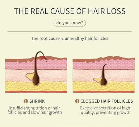 Hair Growth Essential Oil – Reclaim Your Luscious Locks! 🌈