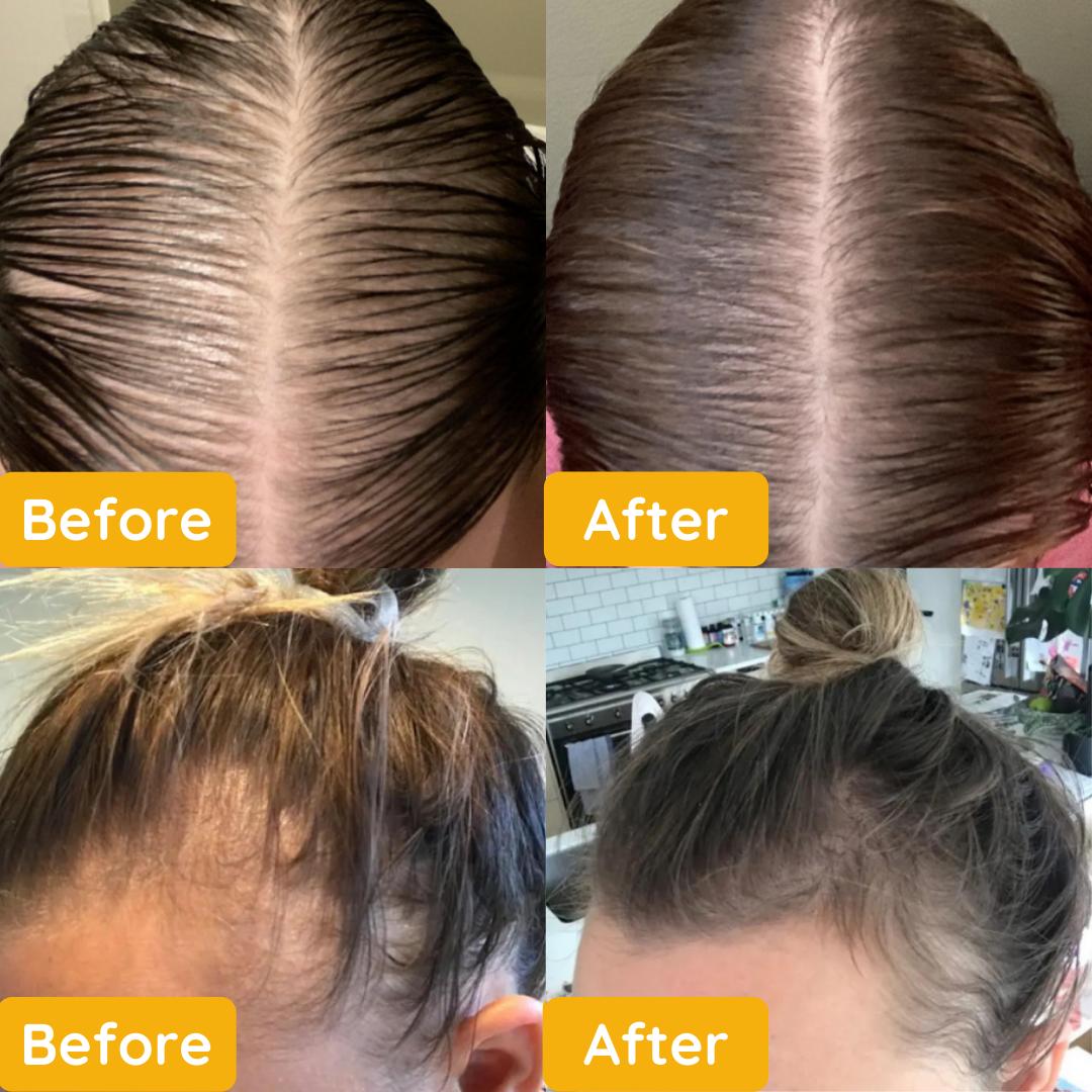 Hair Growth Essential Oil – Reclaim Your Luscious Locks! 🌈